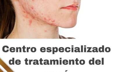 Si tienes problemas de acné estamos para ayudarte