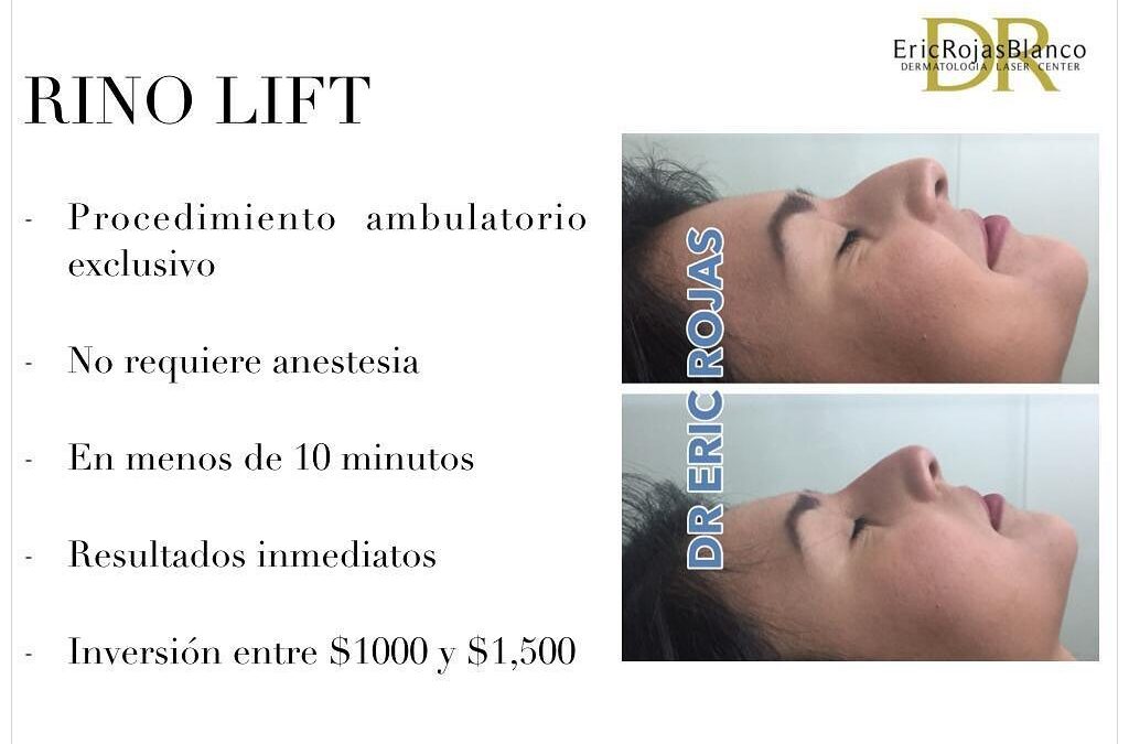 Puede agendar su cita al 22483535