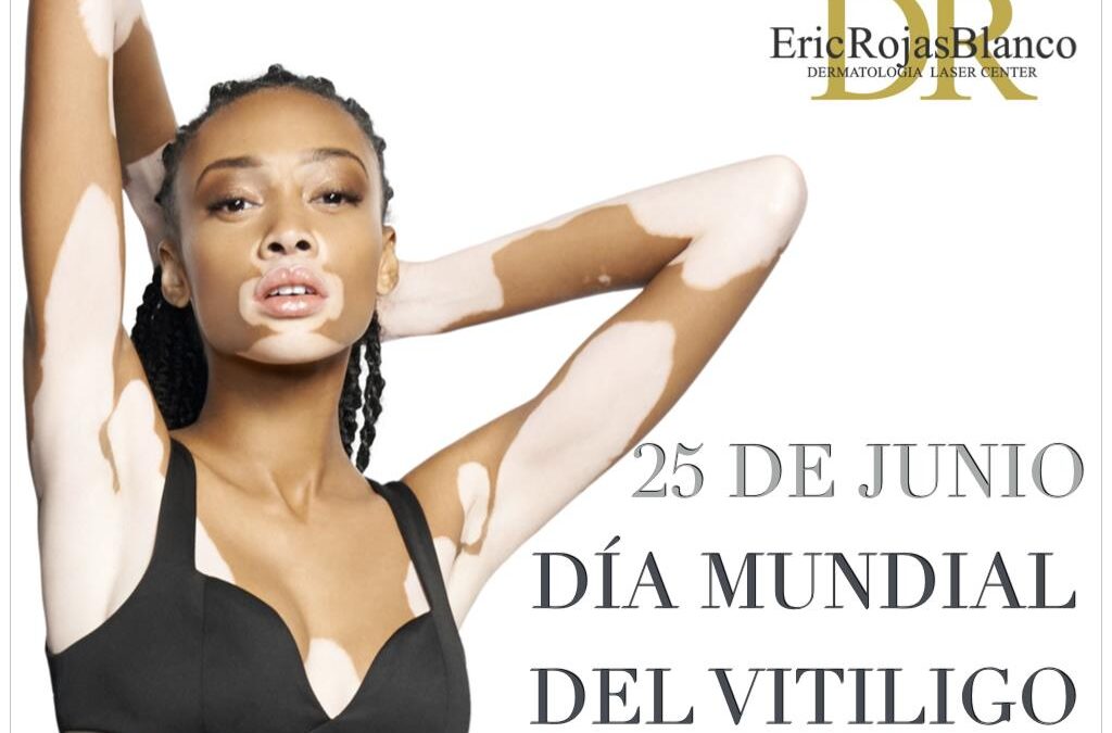 ¿Sabías que tener dos colores en tu piel no te hace diferente a los demás?