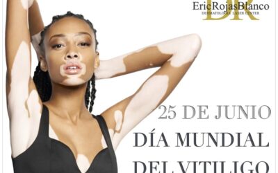 ¿Sabías que tener dos colores en tu piel no te hace diferente a los demás?