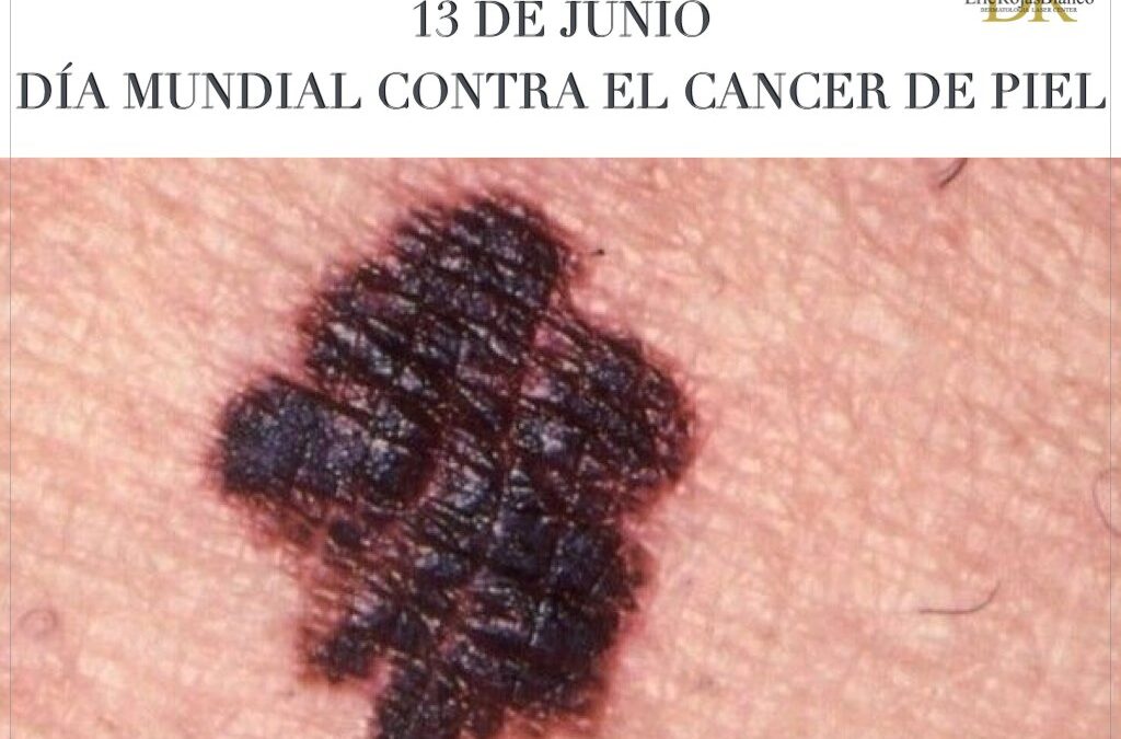 Un día para hacer conciencia, con el propósito de prevenir esta terrible afección en la Piel