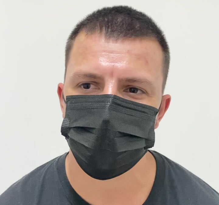 Dermatitis SEBORREICA CÚRATE DR ÉRIC ROJAS 22483535