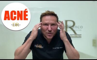 Somos tu mejor opción para tratar y curar el acné Clínica Dr. Eric Rojas Blanco