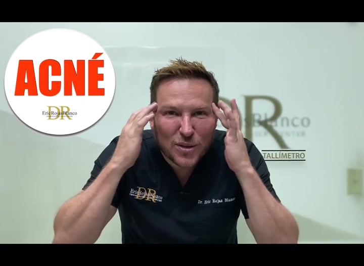 Somos tu mejor opción para tratar y curar el acné Clínica Dr. Eric Rojas Blanco