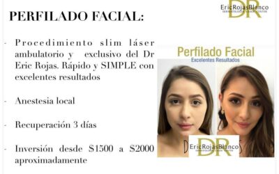 Perfilado facial tenemos el mejor tratamiento.
