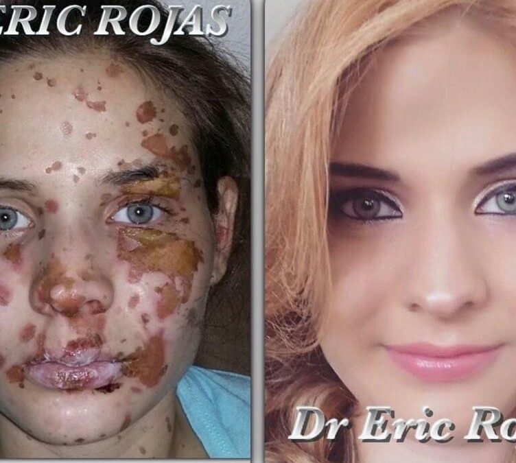 Sea cual sea la situación de tu piel, en la Clinica del Dr. Eric Rojas, lo solucionamos.