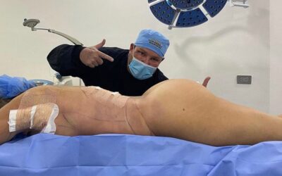 Slim laser