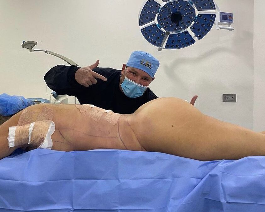 Slim laser
