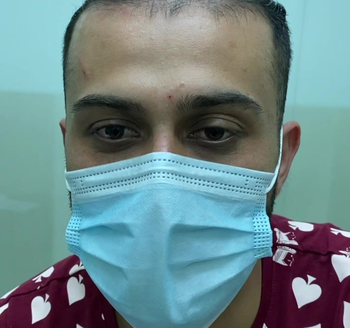 PSORIASIS MEJÓRALA DR ÉRIC ROJAS 22483535