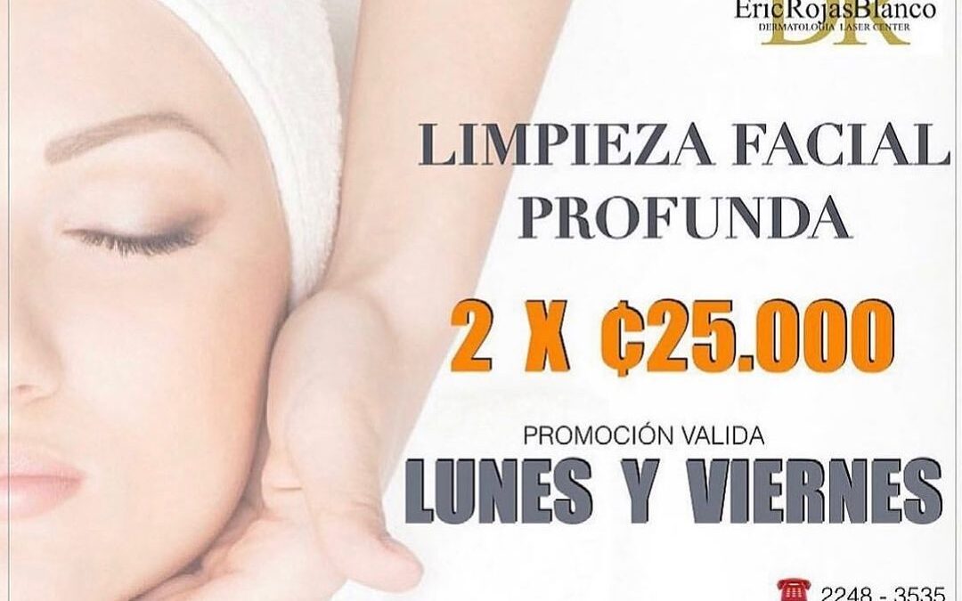Lunes y viernes
