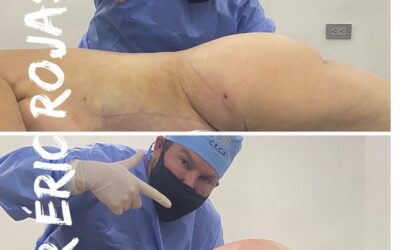 SLIM LÁSER DR ÉRIC ROJAS
