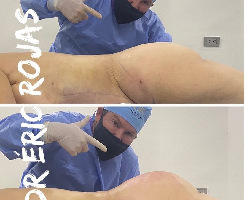 SLIM LÁSER DR ÉRIC ROJAS