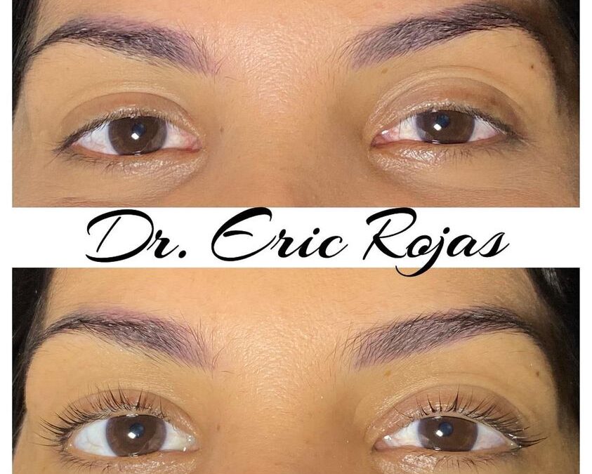 Lifting de pestañas