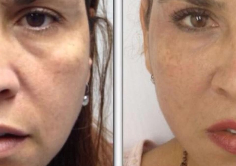 Refresca tu rostro con el tratamiento exclusivo del Dr. Eric Rojas