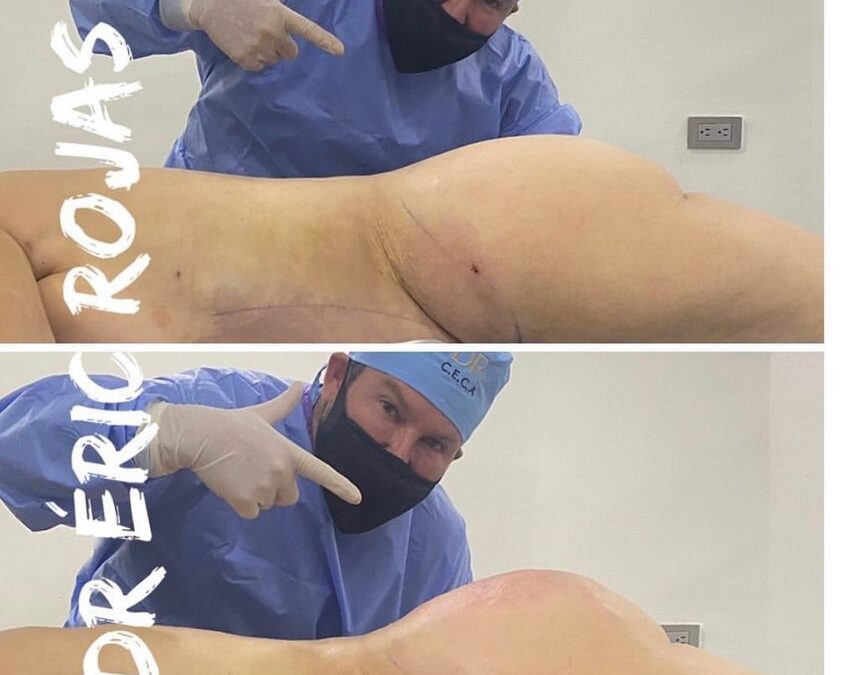 Contamos con el mejor equipo quirúrgico