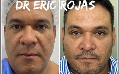 Refresca TU ROSTRO DR ÉRIC ROJAS