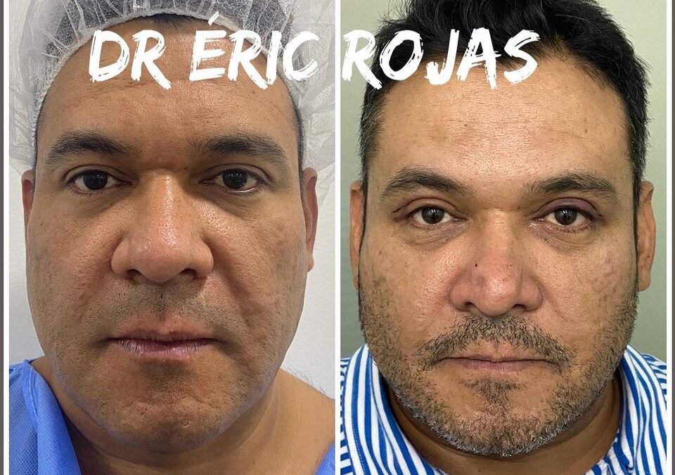 Refresca TU ROSTRO DR ÉRIC ROJAS