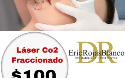 Láser Co2 fraccionado