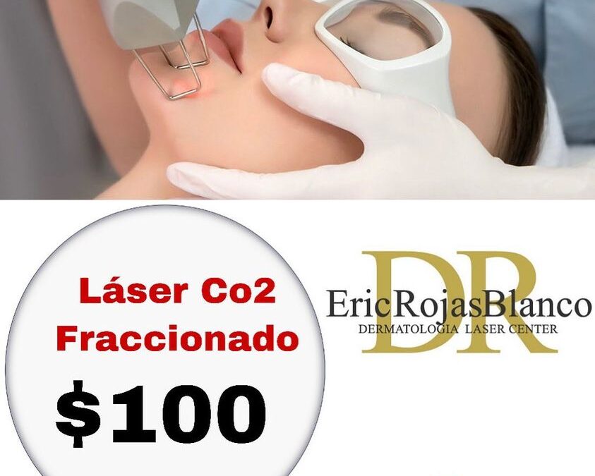 Láser Co2 fraccionado