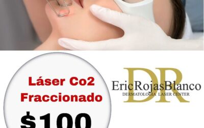 Láser Co2 fraccionado