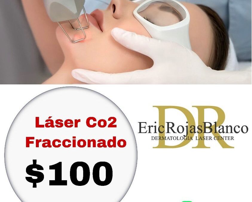 Láser Co2 fraccionado