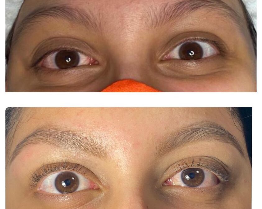 Lifting de pestañas