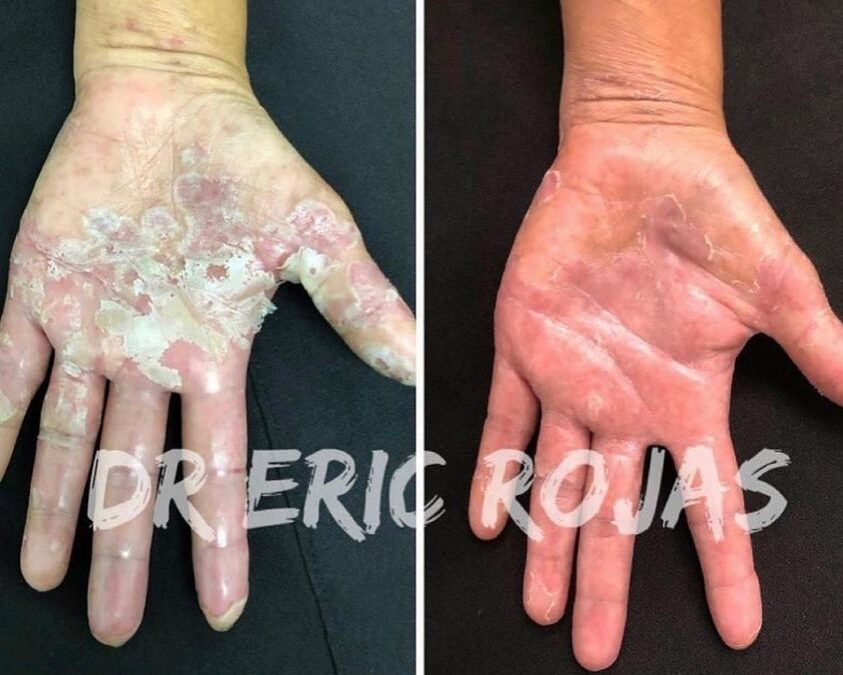 Si tienes este problema y no sabes que hacer !