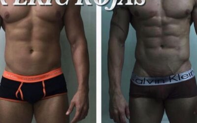 Slim laser en hombres