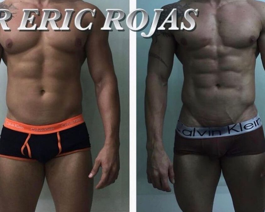 Slim laser en hombres