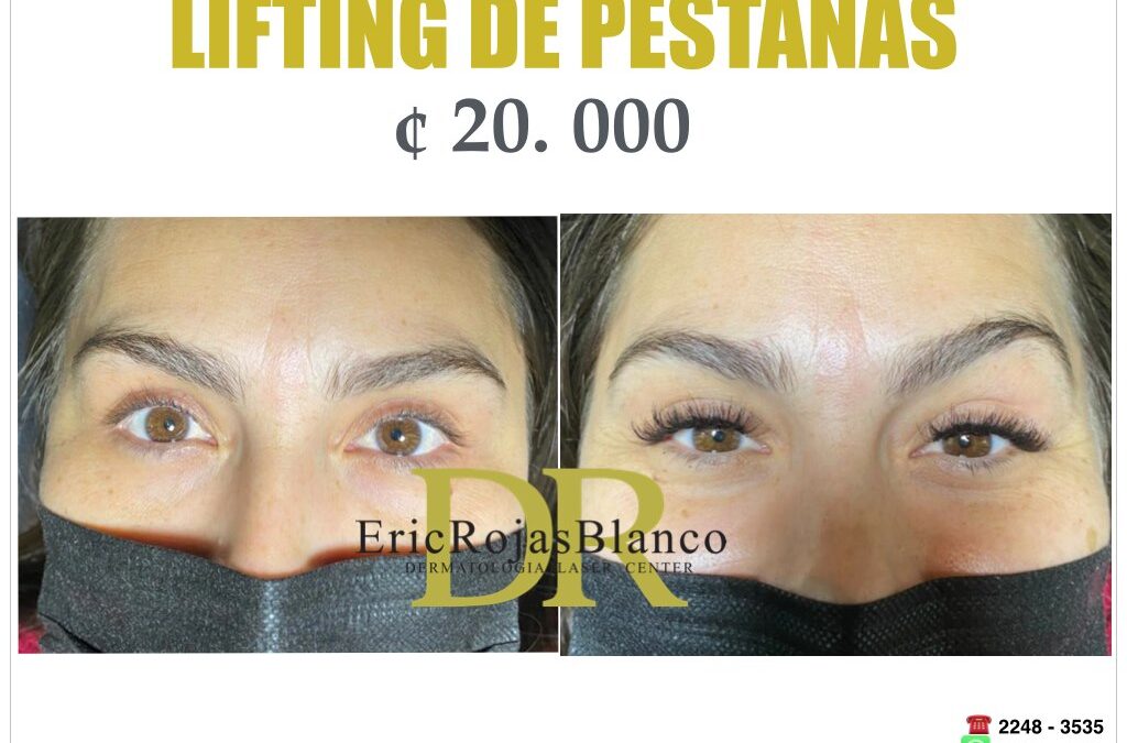 LIFTING DE PESTAÑAS