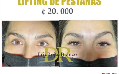 LIFTING DE PESTAÑAS