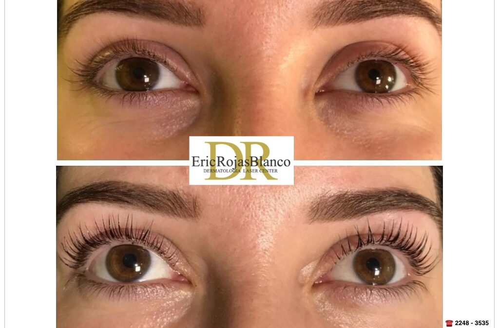 ¿Quieres tener unas pestañas largas y curvadas, sin recurrir a postizos ni a maquillaje?