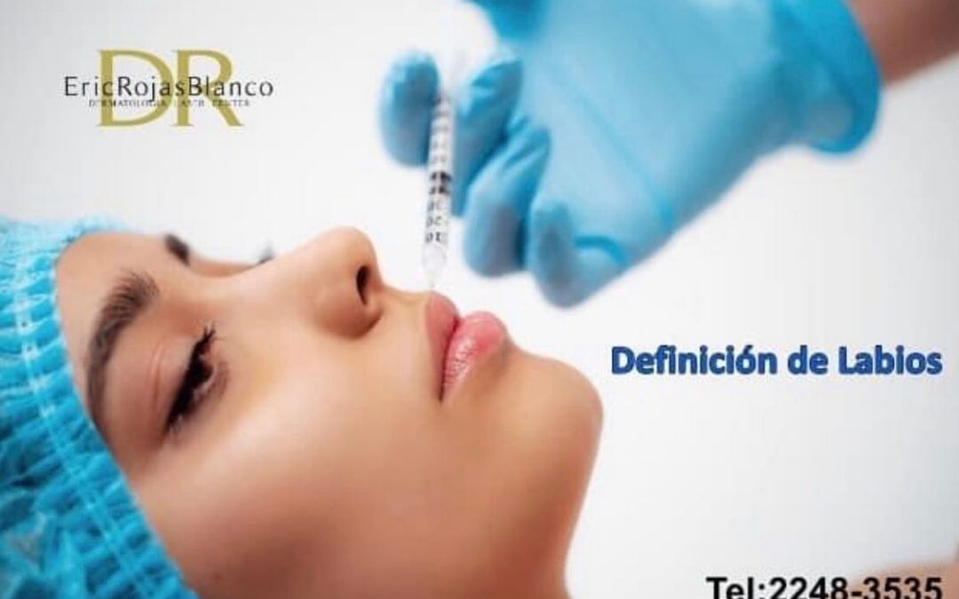 Definición de labios
