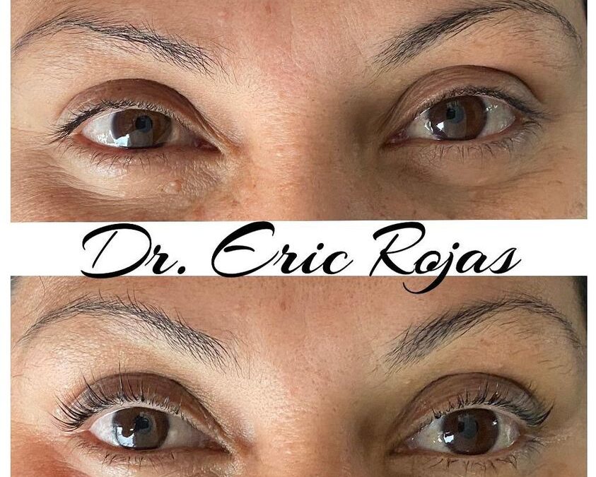 Lifting de pestañas