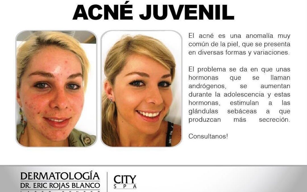 Afecta a la mayoría