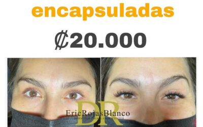 Extensiones de pestañas