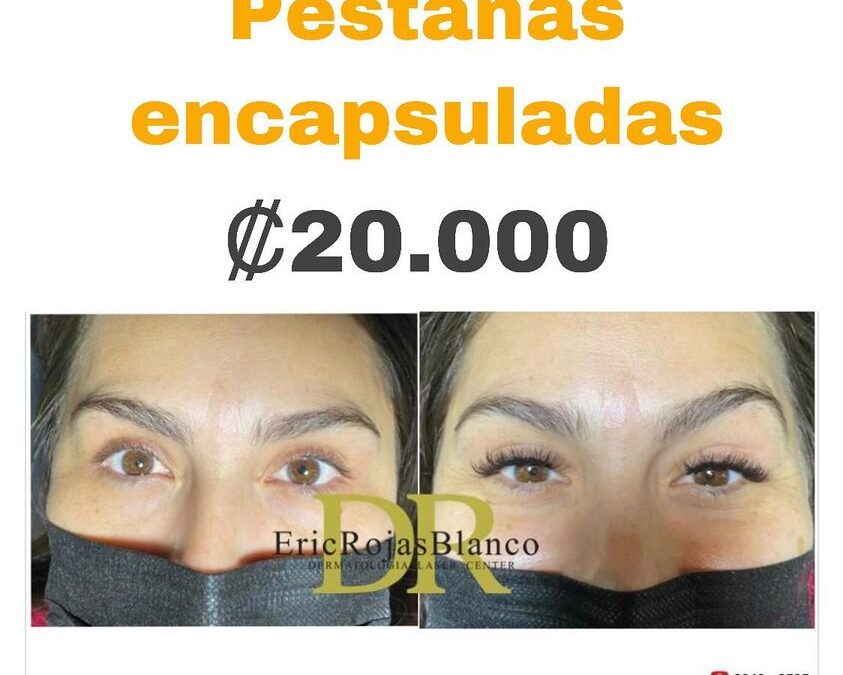 Extensiones de pestañas