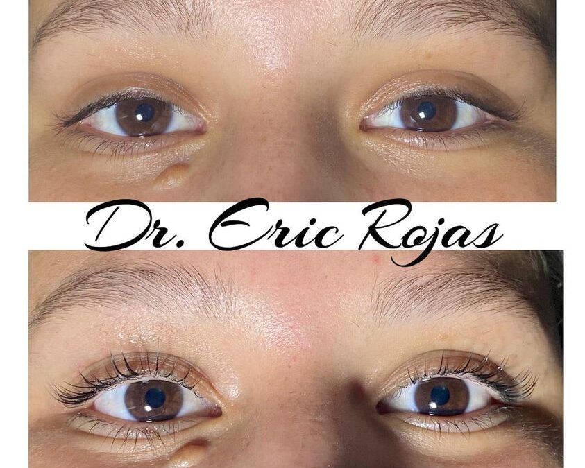 Lifting de pestañas