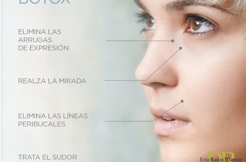 ¿EN QUÉ CONSISTE EL BÓTOX Y QUE ZONAS TRATA?