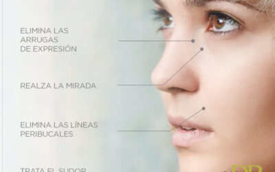 ¿EN QUÉ CONSISTE EL BÓTOX Y QUE ZONAS TRATA?