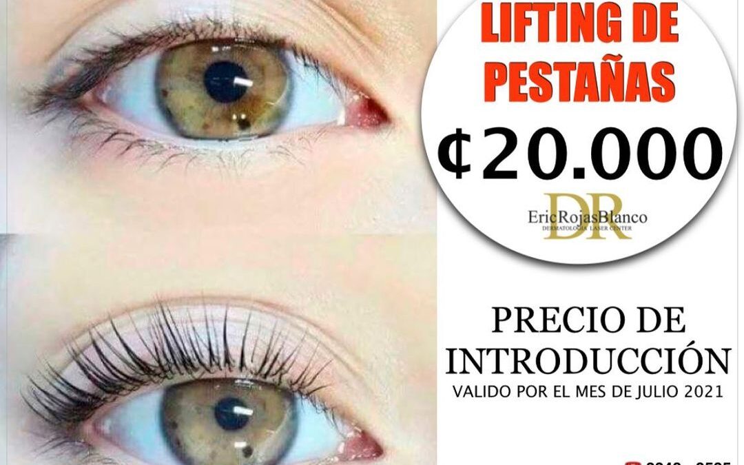 Agenda tu cita ya al 61793535