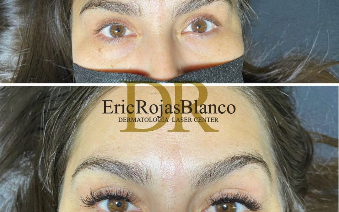 Pestañas encapsuladas