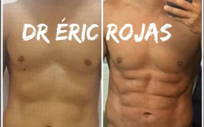 SLIM LÁSER DR ÉRIC ROJAS 22483535