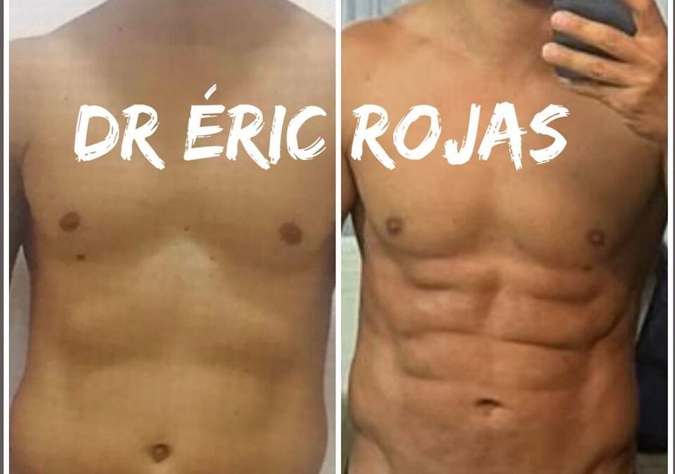 SLIM LÁSER DR ÉRIC ROJAS 22483535