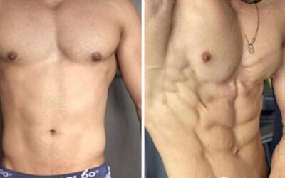Slim laser