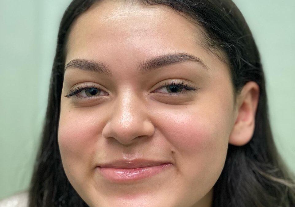 Rostros SIN ACNÉ DR ÉRIC ROJAS