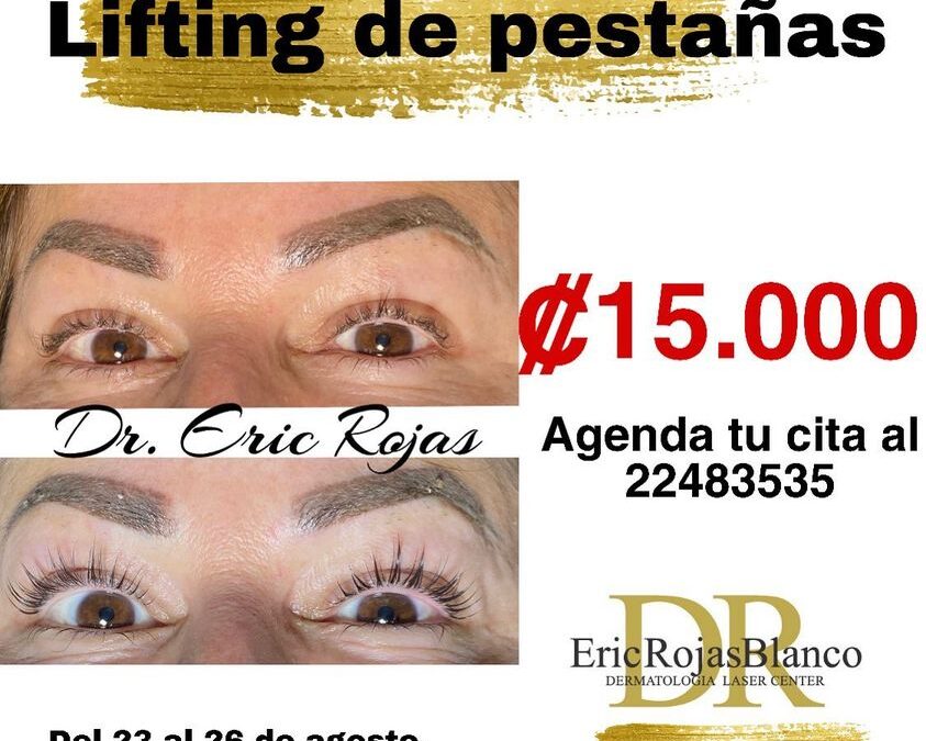 Lifting de pestañas