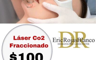 Láser fraccionado