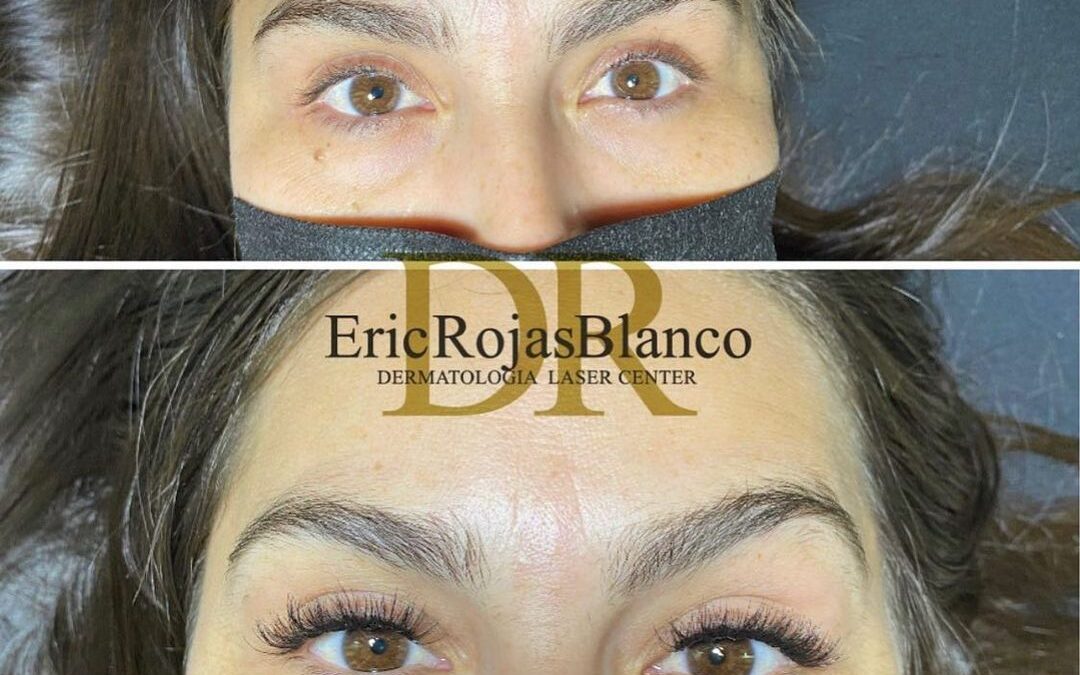 Extensiones de pestañas