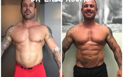 Resultados reales Slim Láser